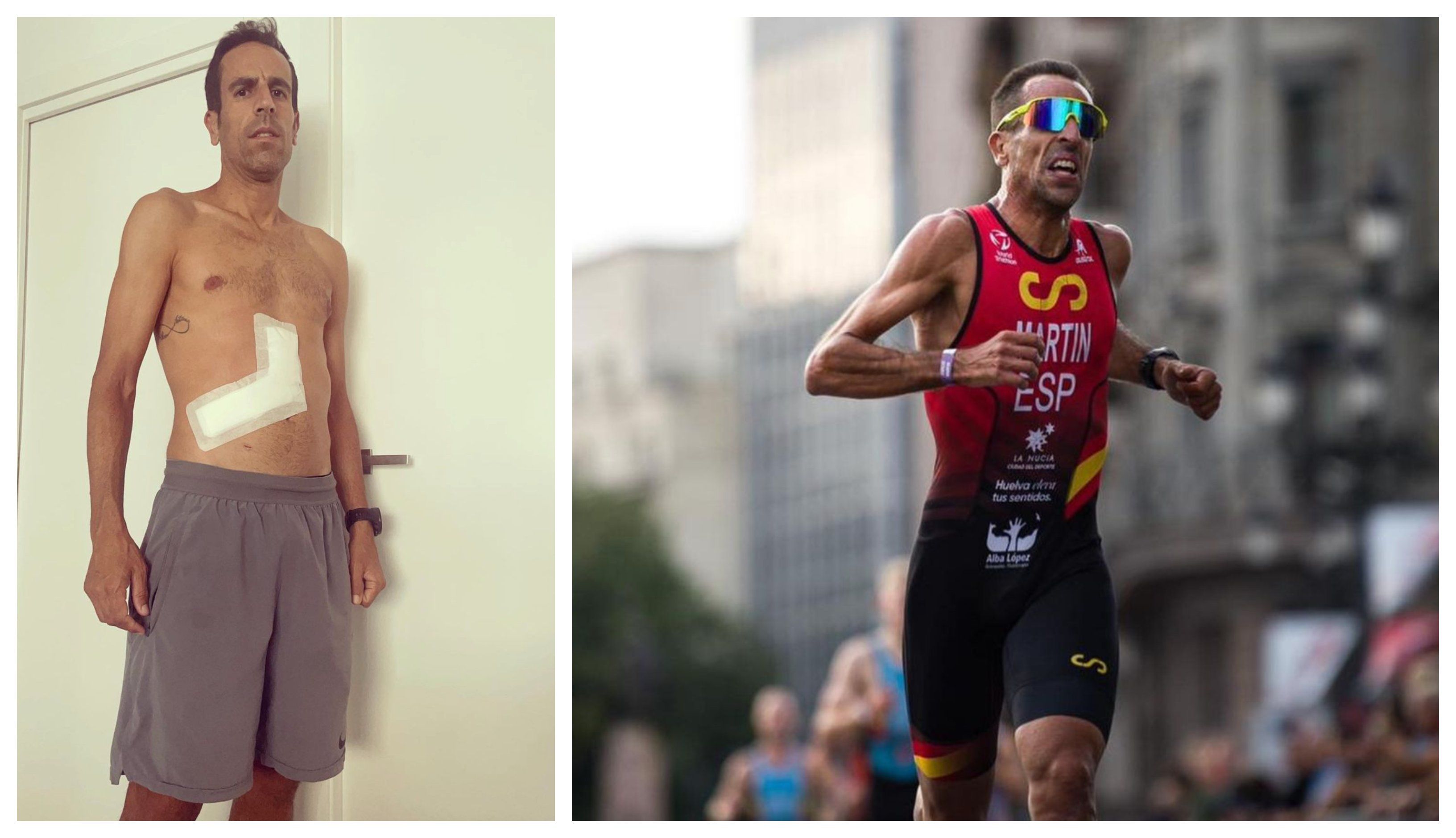 El excampeón mundial de duatlón Emilio Martín iniciará un tratamiento de quimioterapia