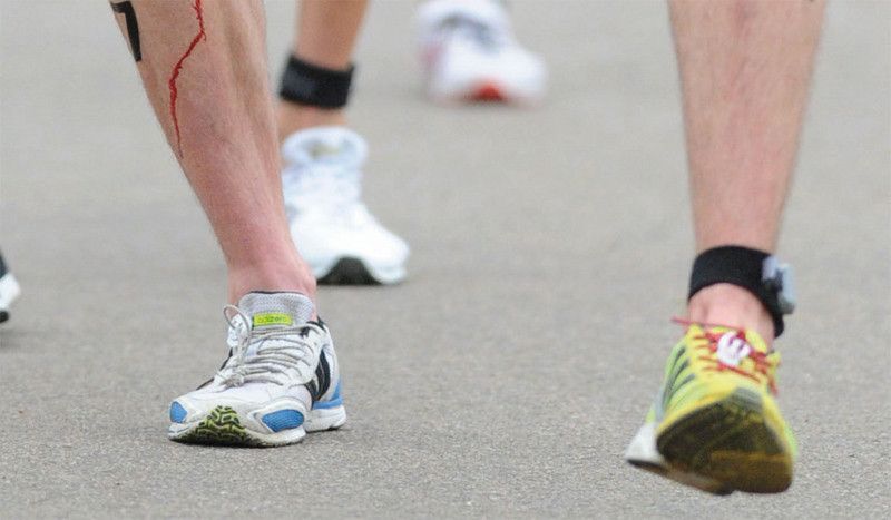 El neuroma de Morton