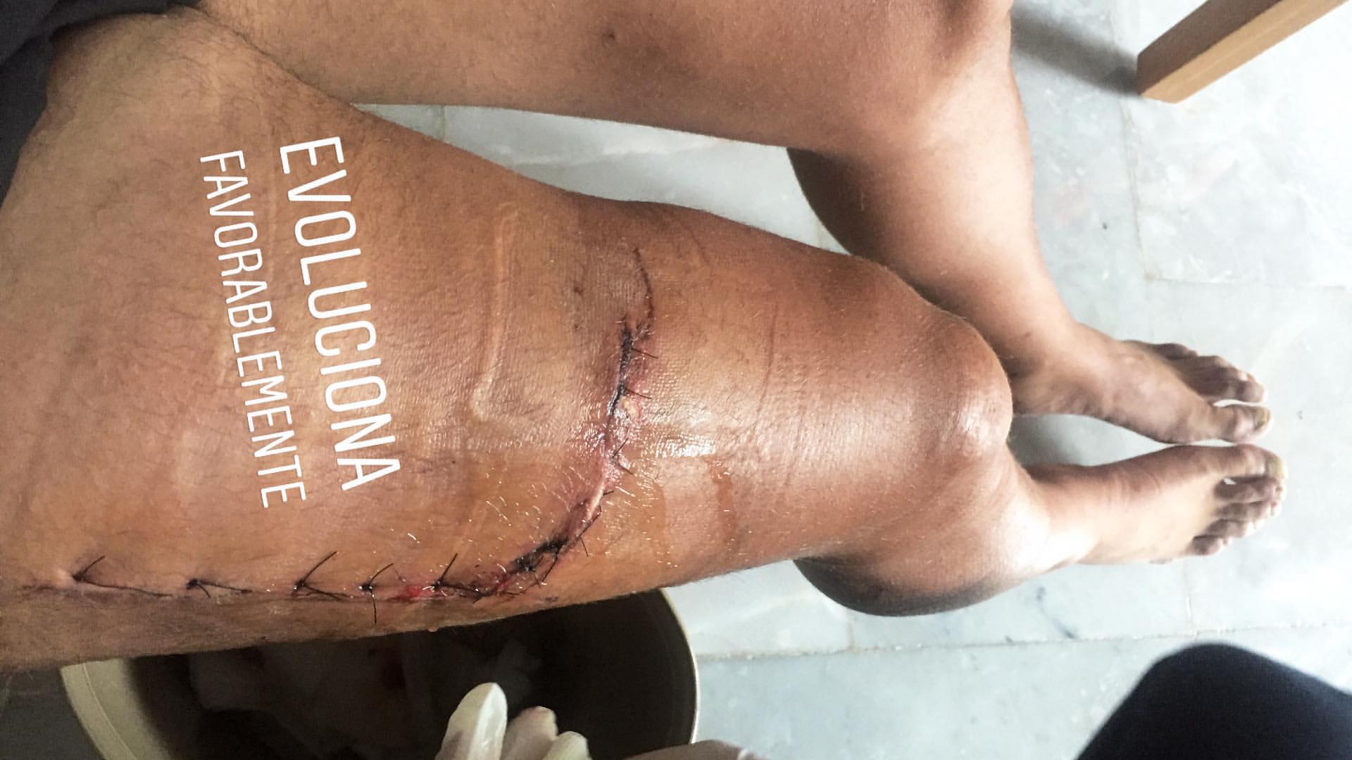 Imágenes del accidente de Víctor Arroyo