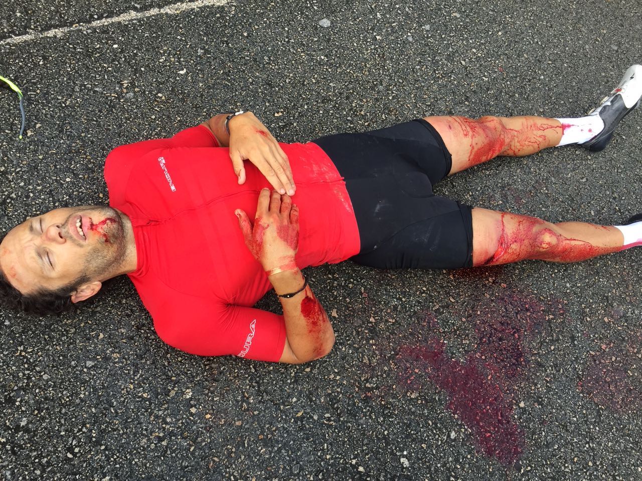Imágenes del accidente de Víctor Arroyo