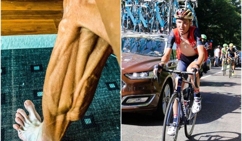 La impactante imagen de la pierna de Jani Brajkovič