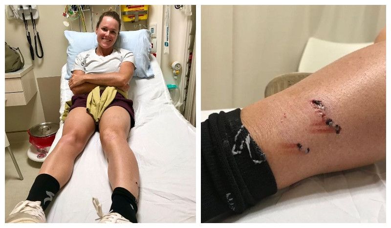 El "drama" navideño de Flora Duffy: ¡Un perro le muerde en la pierna mientras corría!