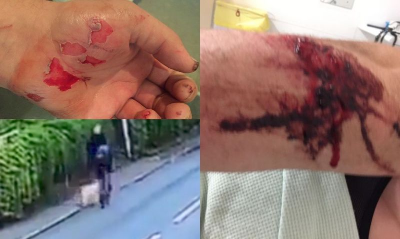 "A éste sí tendrían que expulsarle del Tour..."
