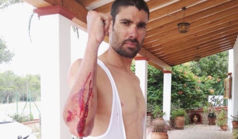 Una conductora se da a la fuga tras provocar la caída del triatleta Javi Cardona