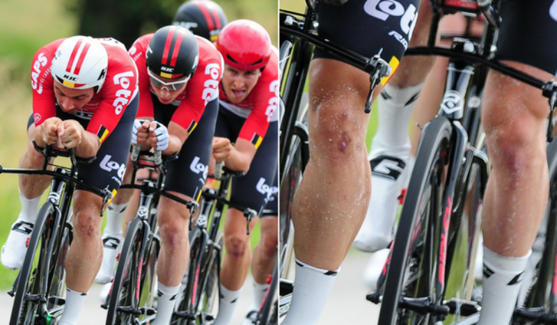 La UCI investiga el gel aerodinámico utilizado por Lotto Soudal