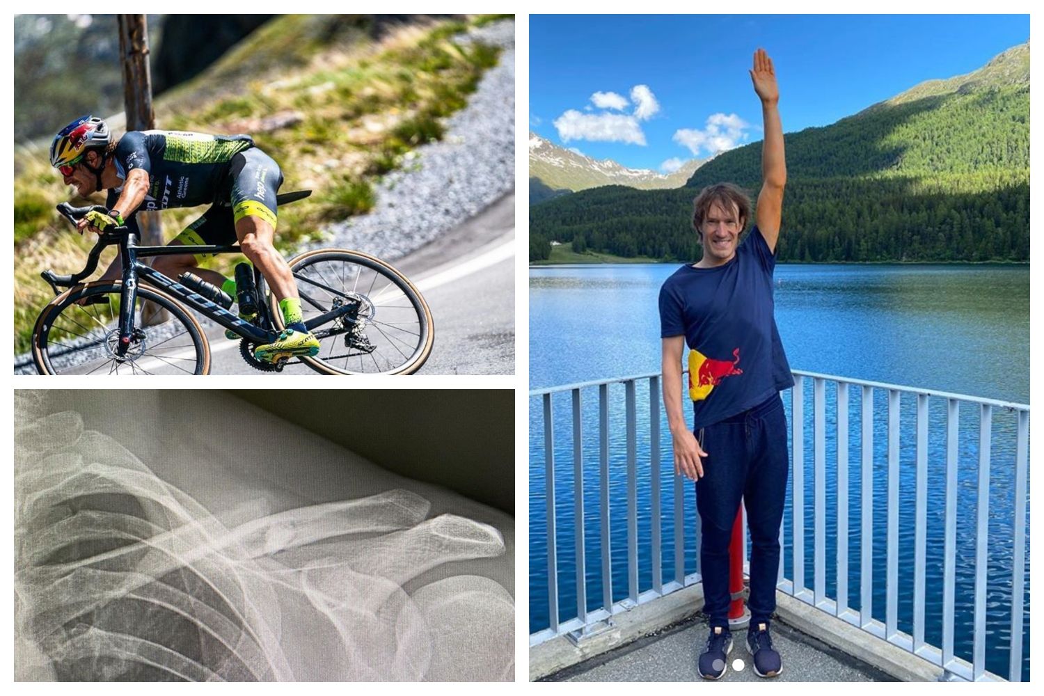 Sebastian Kienle se fractura la clavícula en una caída de bici: "Es un buen momento para rompérsela".