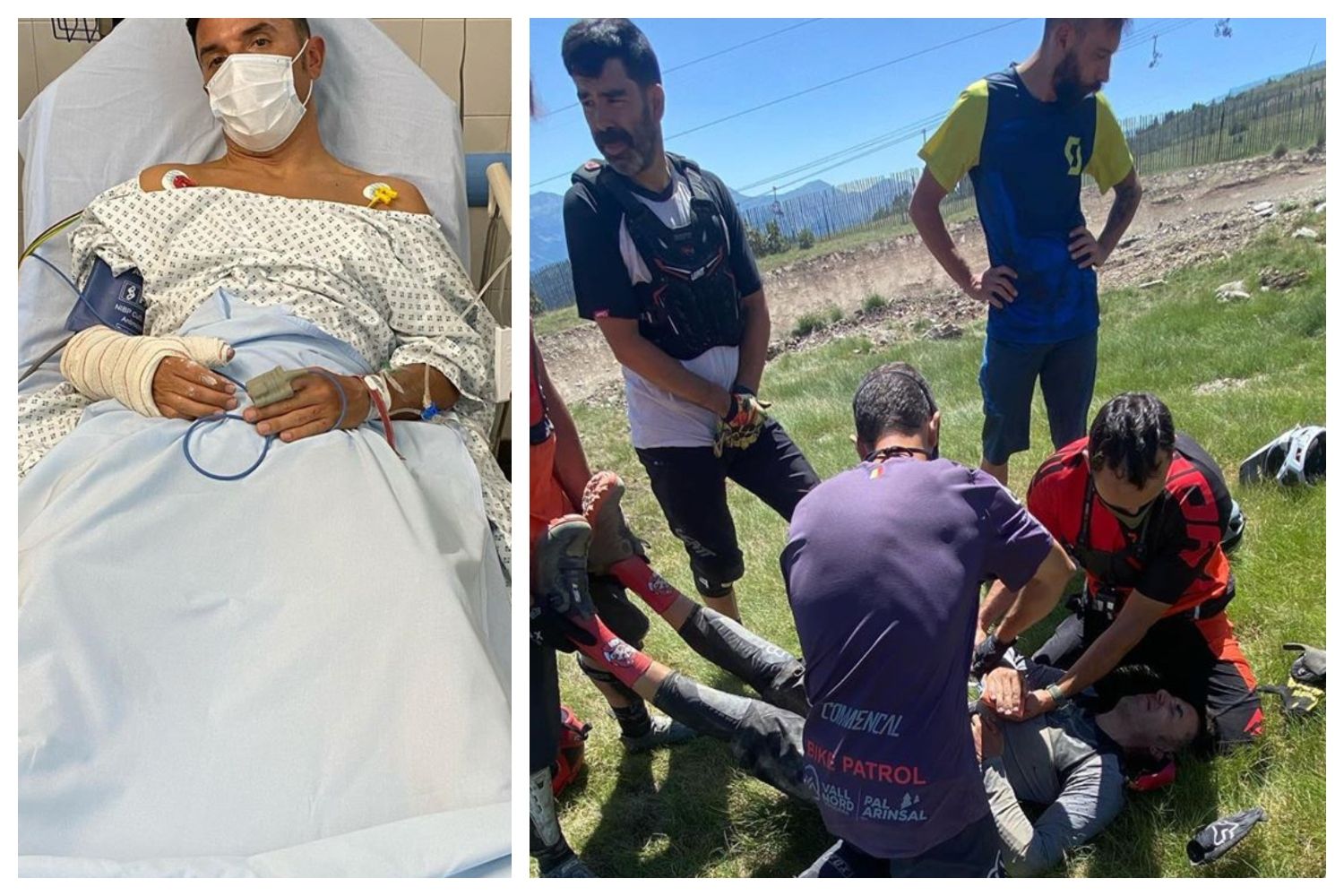 ‘Purito’ se operará tras sufrir una fuerte caída con la MTB: “Es un palo gordo y un buen susto".