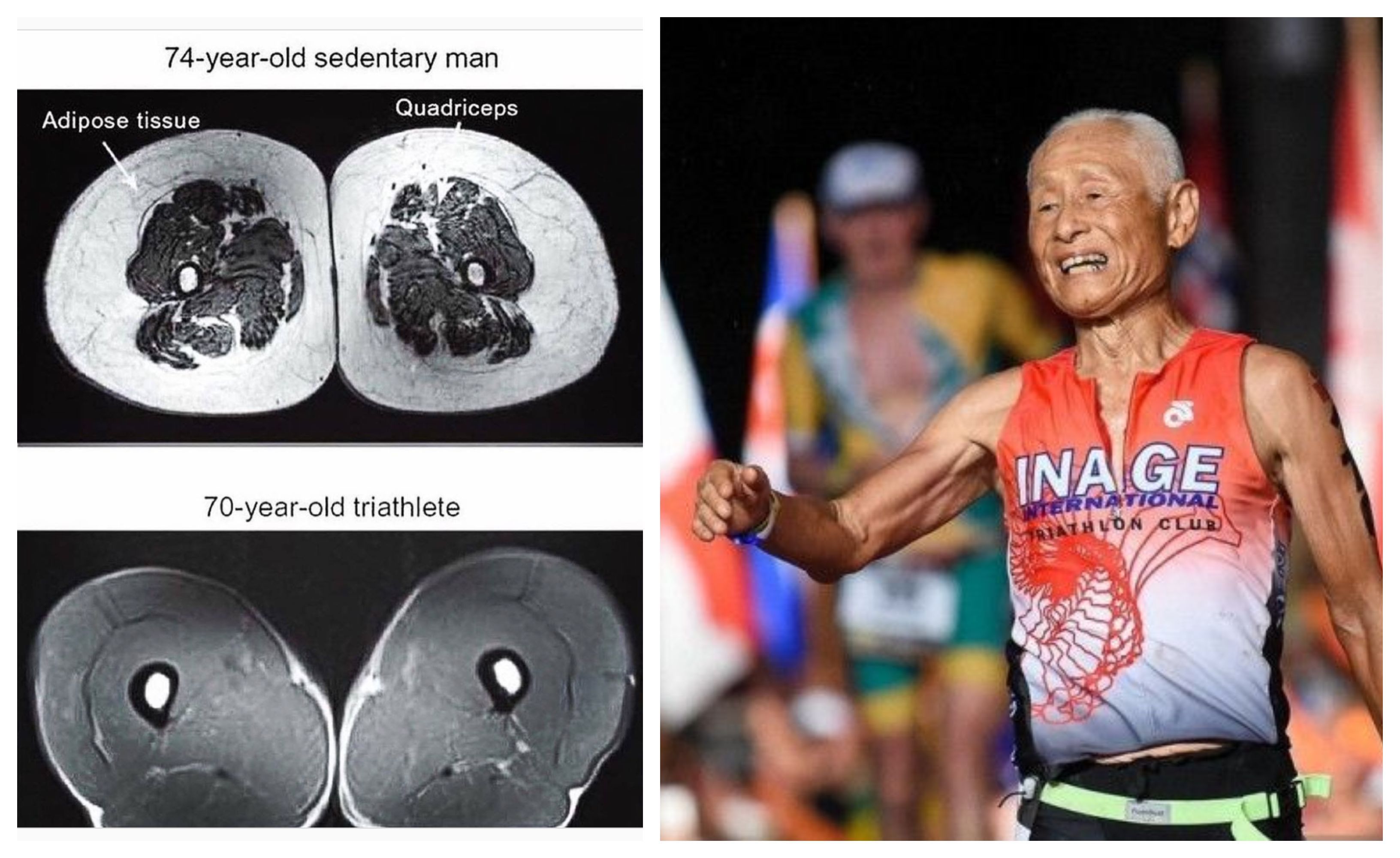 ¿Por qué debes hacer triatlón toda la vida  Mira la imagen de las piernas de un triatleta de 70 años