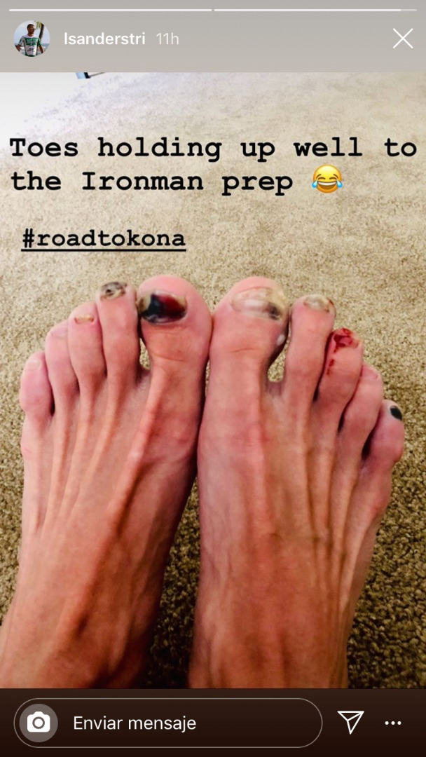 Así se le están quedando las uñas a uno de los aspirantes al Mundial Ironman de Kona